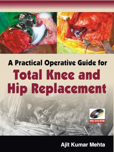 A practical operative guide for total knee and hip replacement - 9780071634373
