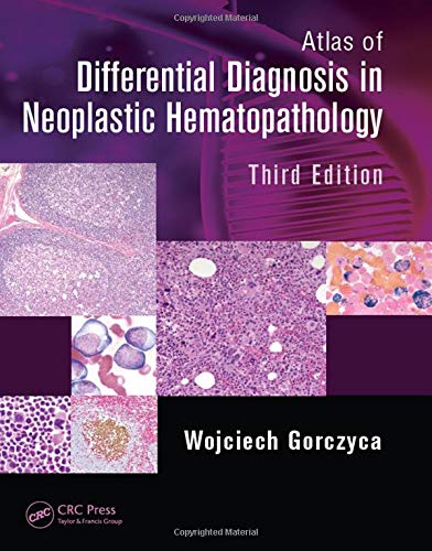 Atlas of differential diagnosis in neoplastic hematopathology