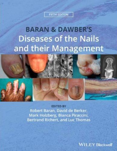 Baran Dawbers Diseases Of The Nails And Their Management 5Th Edition
