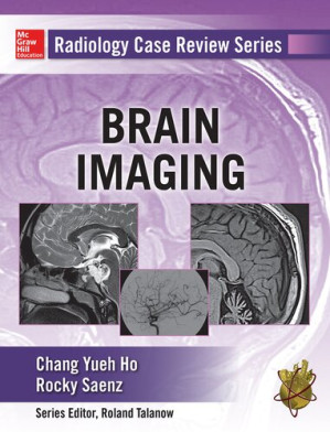 Brain imaging by Chang Yueh Ho; Rocky Saenz