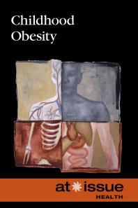 Childhood Obesity By Tamara Thompson