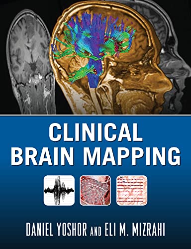 Clinical brain mapping by Yoshor, Daniel; Mizrahi, Eli M