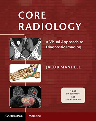 Core Radiology: A Visual Approach to Diagnostic Imaging - 1st Edition