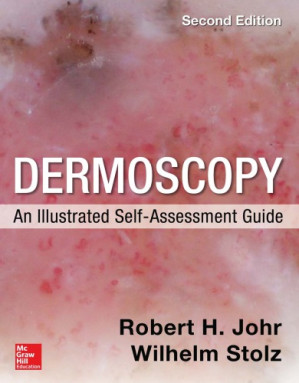Dermoscopy - An Illustrated Self-Assessment Guide 2 ed. By Johr Robert H.; Stolz Wilhelm