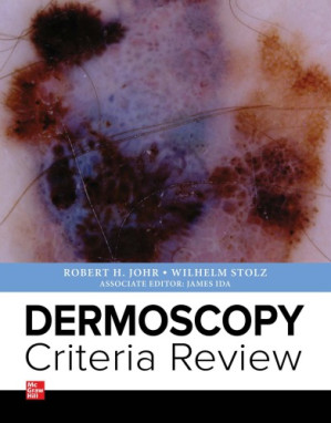 Dermoscopy Criteria Review By Robert Johr, Wilhelm Stolz