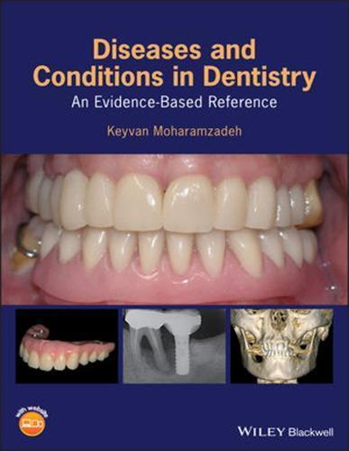 Diseases And Conditions In Dentistry An Evidence Based Reference