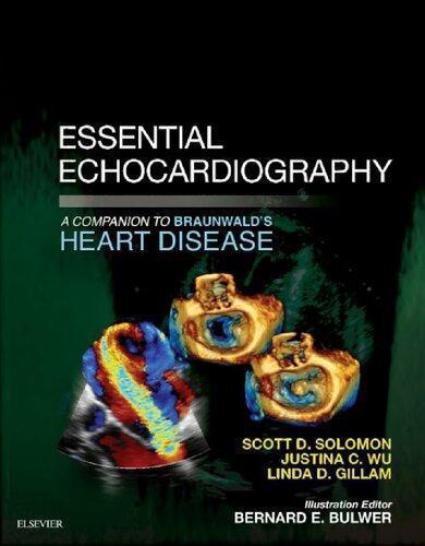 Essential Echocardiography A Companion To Braunwalds Heart Disease