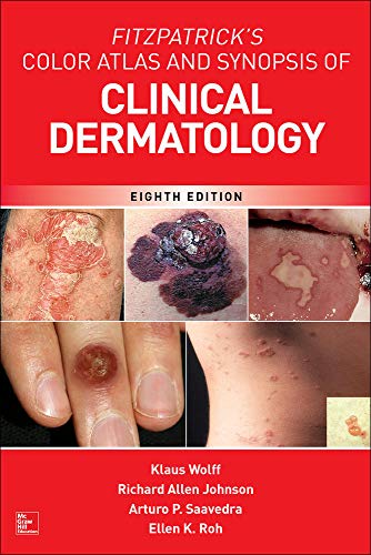 Fitzpatrickâ€™s Color Atlas and Synopsis of Clinical Dermatology - 8th Edition