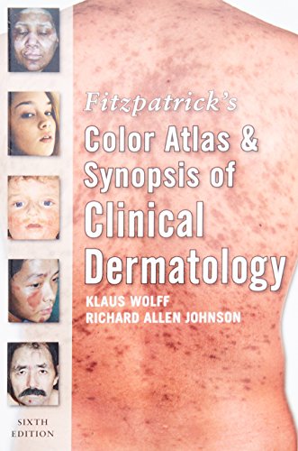 Fitzpatrick's Color Atlas and Synopsis of Clinical Dermatology: Sixth Edition - 9780071599757