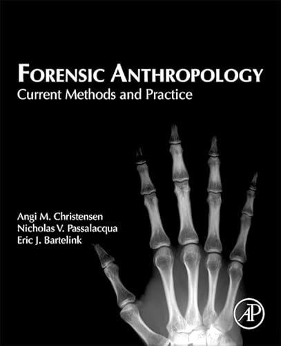 Forensic Anthropology. Current Methods and Practice