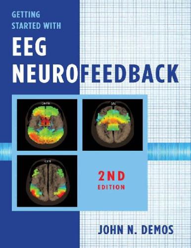 Getting Started With Eeg Neurofeedback