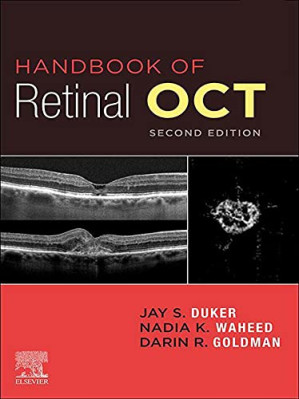 Handbook of Retinal OCT: Optical Coherence Tomography