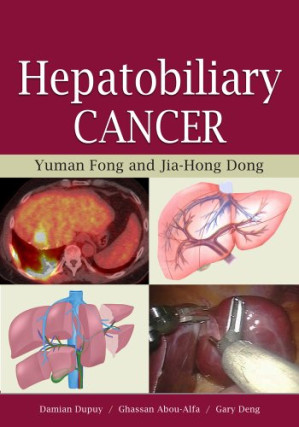 Hepatobiliary Cancer by Yuman Fong, Jia-Hong Dong