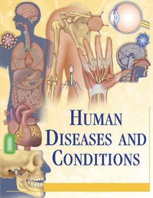Human Diseases and Conditions  4 Volume Set By Miranda Herbert Ferrara