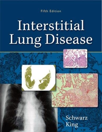 Interstitial lung disease - 9781607950240
