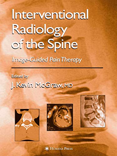 Interventional Radiology in Pain Treatment
