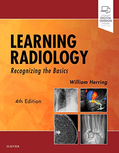 Learning Radiology: Recognizing the Basics - 9780323567299