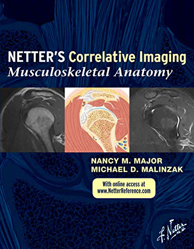 Netterâ€™s Correlative Imaging: Musculoskeletal Anatomy: with Online Access at www.NetterReference.com, 1e