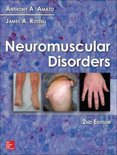Neuromuscular Disorders 2Nd Edition Amato