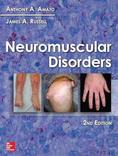 Neuromuscular Disorders by Anthony A. Amato, James A. Russell