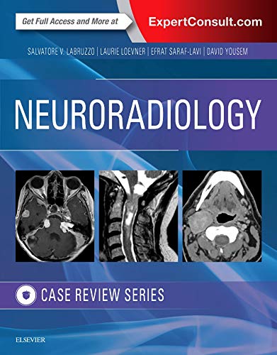 Neuroradiology Imaging Case Review - 1st Edition