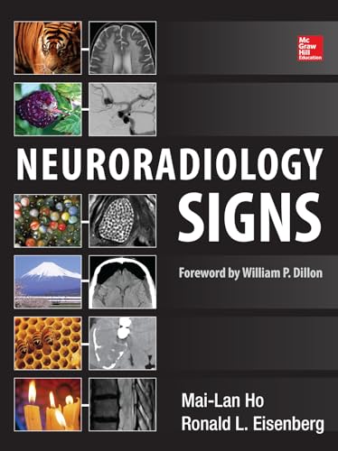 Neuroradiology Signs - 9780071804325