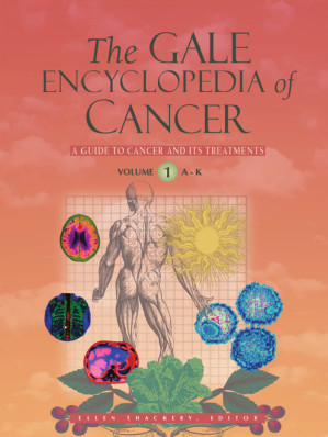 The Gale encyclopedia of cancer : a guide to cancer and its treatment By ELLEN THACKERY, EDITOR