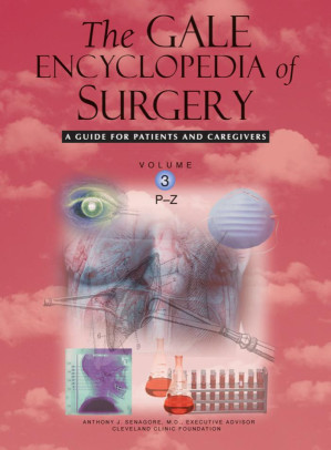 The Gale encyclopedia of surgery: a guide for patients and caregivers Volume 1 By Anthony J. Senagore - 9789604032006