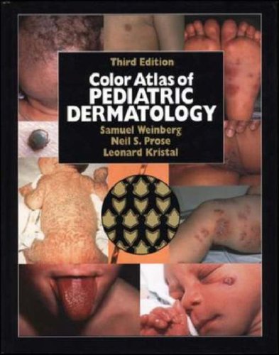 color atlas of pediatric dermatology